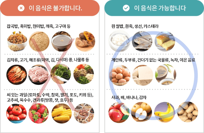 대장내시경 전에 피해야 할 섬유질 많은 음식들